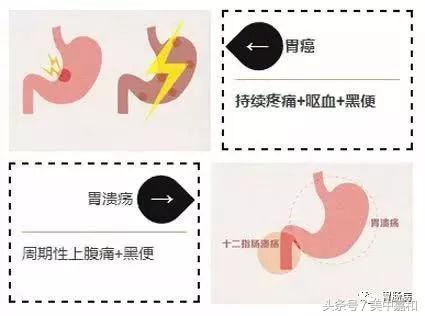 暗红色的便血一定是肠癌吗,大便便血是什么病的前兆