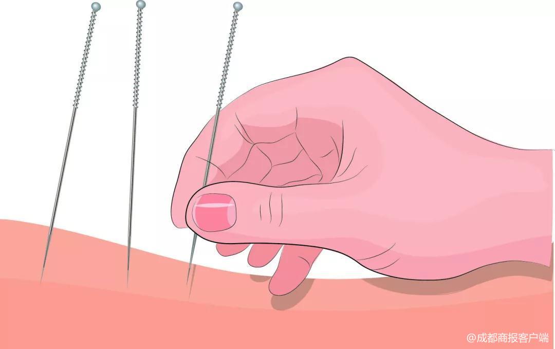 颈椎受损瘫痪病人康复办法,颈椎损伤瘫痪早期康复锻炼视频