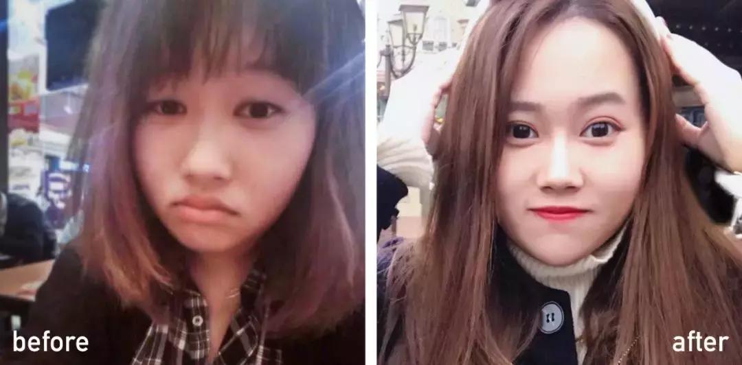 整容最成功的人前后对比,整容最成功的4位