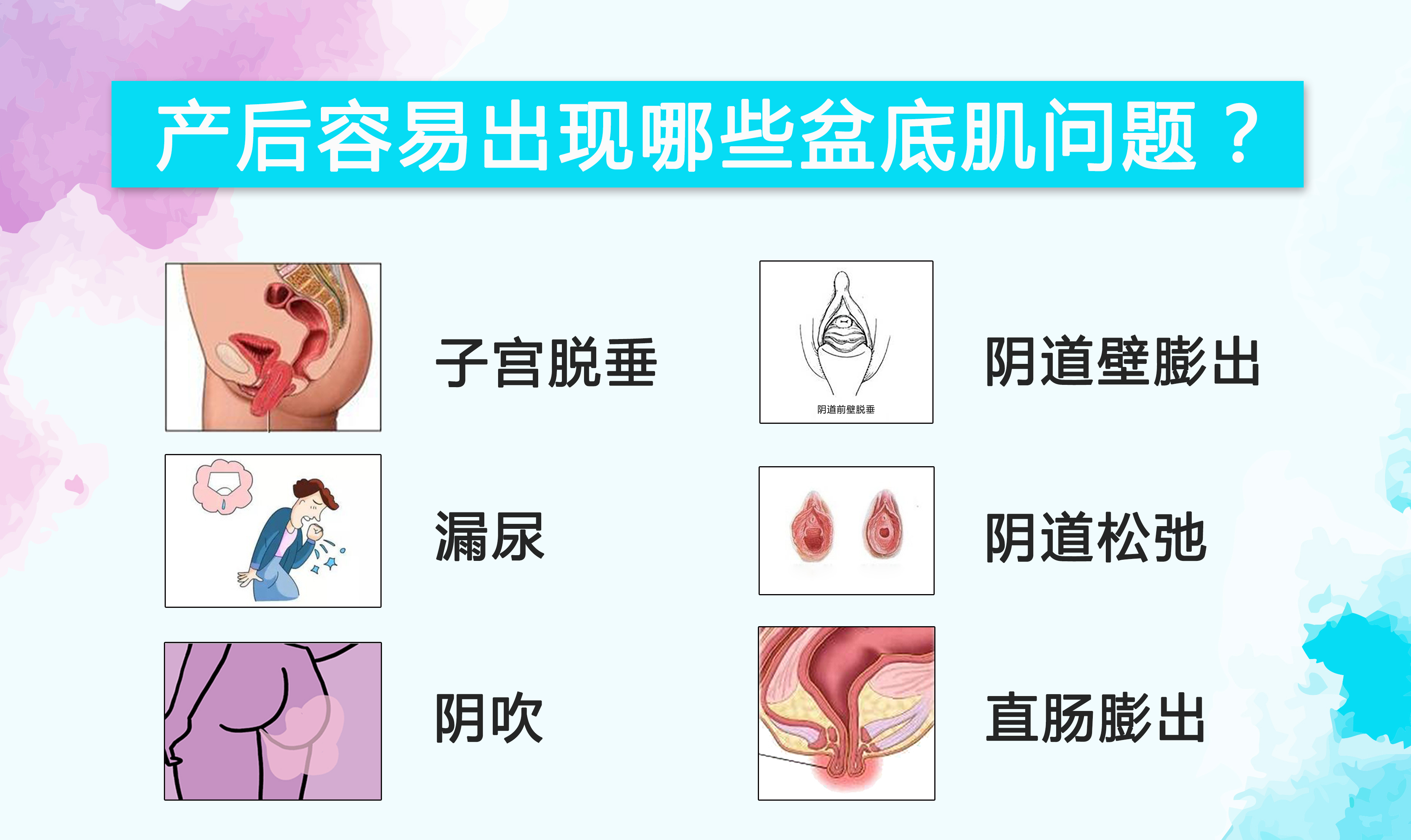 盆底康复，每个女人都应该了解……
