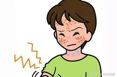 晒太阳皮肤起小红点过敏,脸一晒太阳反反复复过敏怎么办