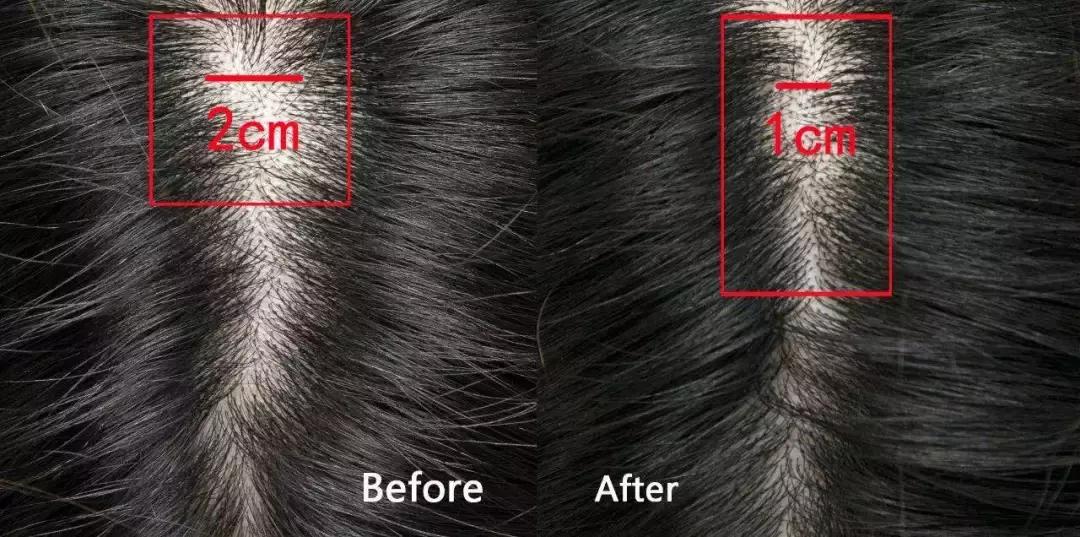 一个悲剧，小贝一家终究逃不过“英国魔咒”！