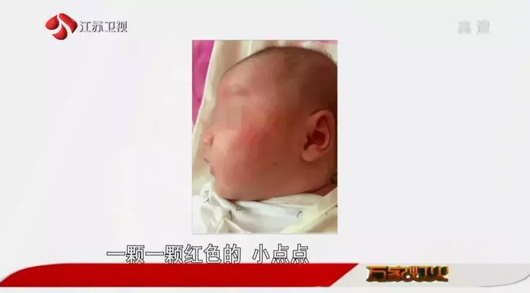 季节更替怎么预防皮肤病,皮肤病痒疹的关注事项