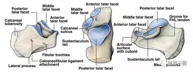 跟骨误诊,影像学误诊