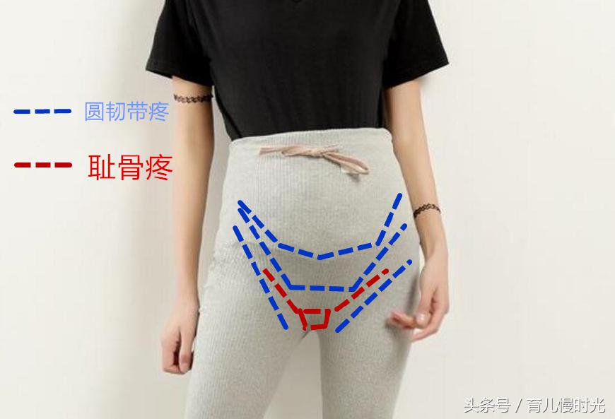 怀孕后各种不适如何区分？水肿胎动耻骨疼和宫缩的真伪揭秘