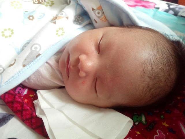 宝宝淹脖子用什么方法解决,宝宝淹脖子是什么原因引起的