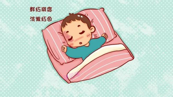 刚刚出生婴儿脸上长了肉痣怎么办,8个月宝宝脸上长雀斑样痣