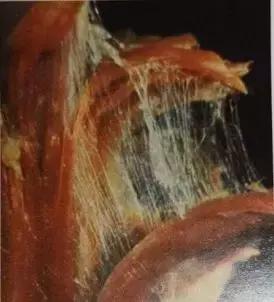 汤氏颈肩腰腿痛正骨手法,林州专业手法调理颈肩腰腿疼