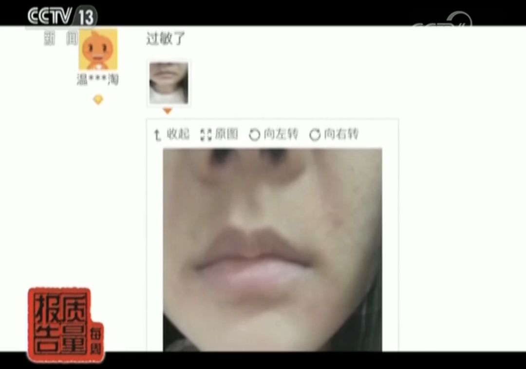 你用的面膜添加激素了吗,你用的面膜含有175项安全检测吗