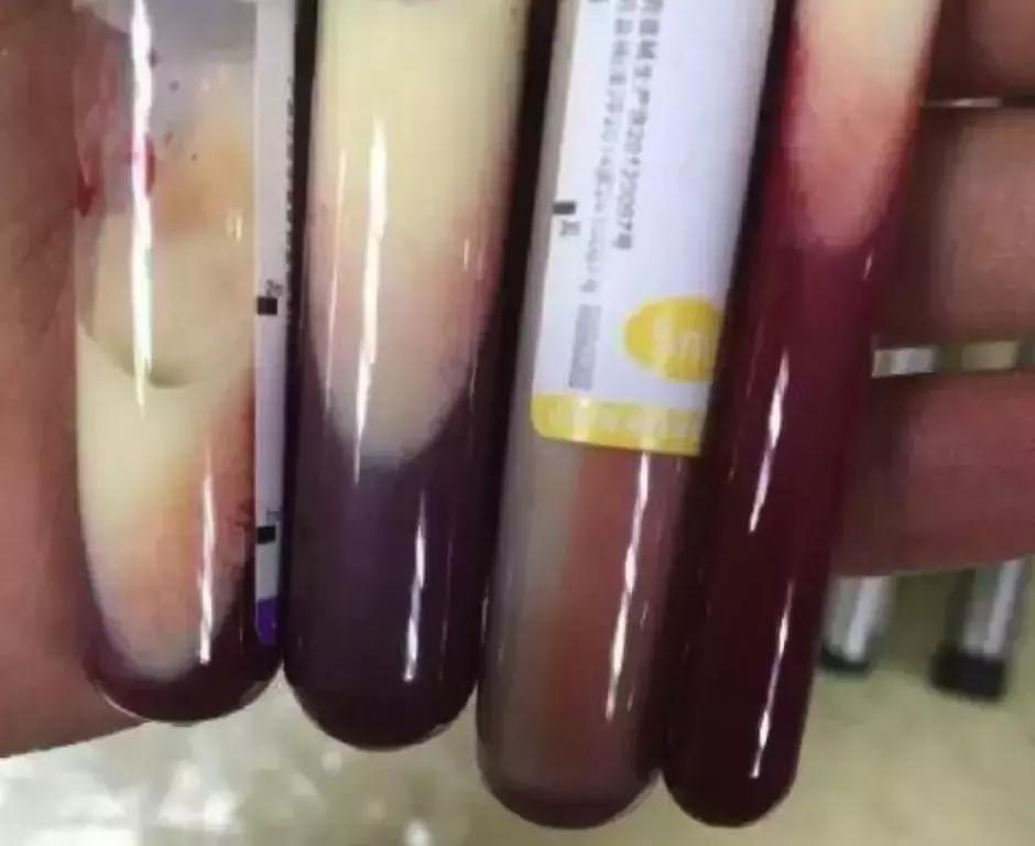 好好吃饭才是最好的爱自己,好好吃饭真的是一种高级人生聪颖