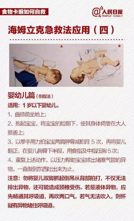 孩子被异物卡喉被救活的几率多大,孩子异物卡喉咙海姆立克急救法