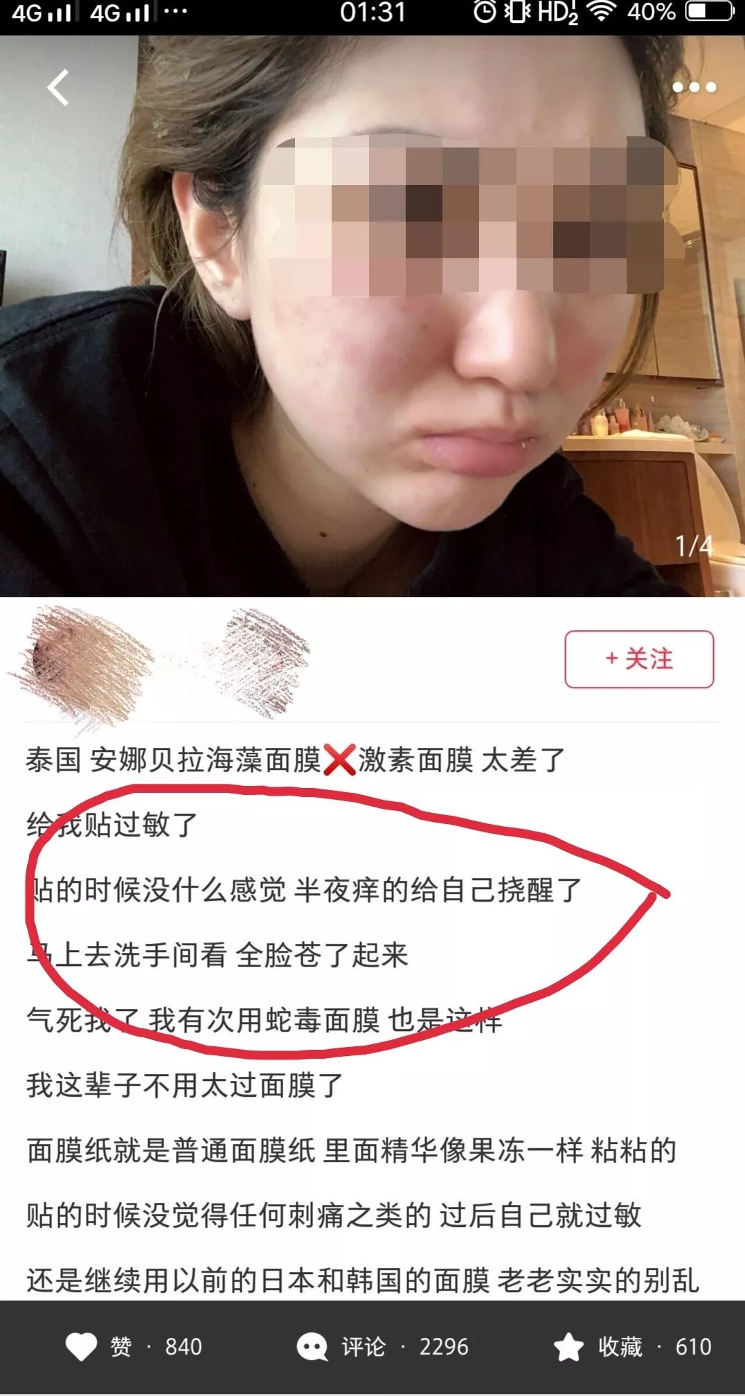 泰国ray面膜被爆含激素,泰国面膜曝光