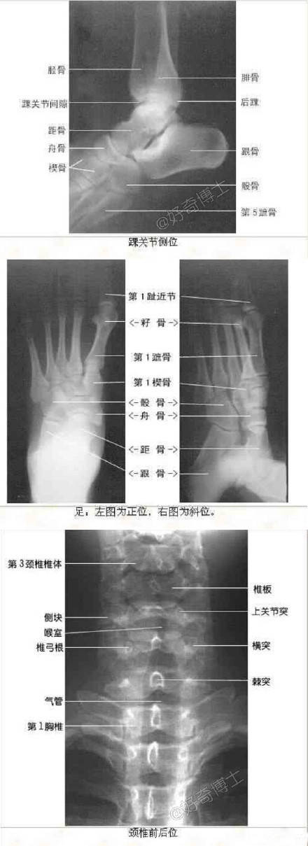 教你如何看X线片子的最全整理