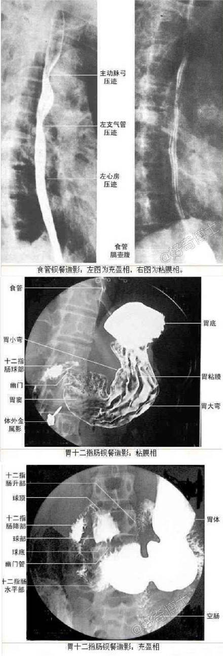 教你如何看X线片子的最全整理