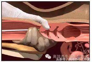 给牛人工授精完成后续关注事项,给牛人工授精需要关注什么