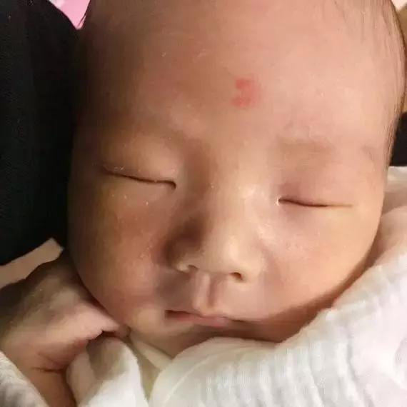 宝宝起红疹子破皮流血怎么办,一岁婴儿身上起红疹小点鉴别