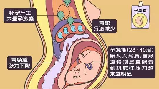 怀宝宝以后不便秘了,孕早期便秘对宝宝有哪些影响