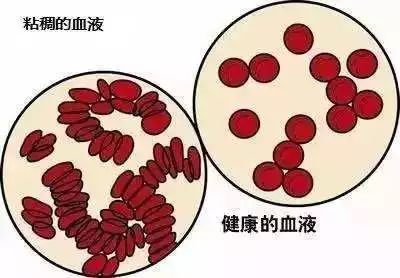 血液粘稠怎么调理喝什么茶,血液粘稠血压会高吗怎么调理