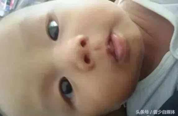 宝宝鼻梁有青筋真的比较难养吗,青筋难养鼻梁有青筋的宝宝