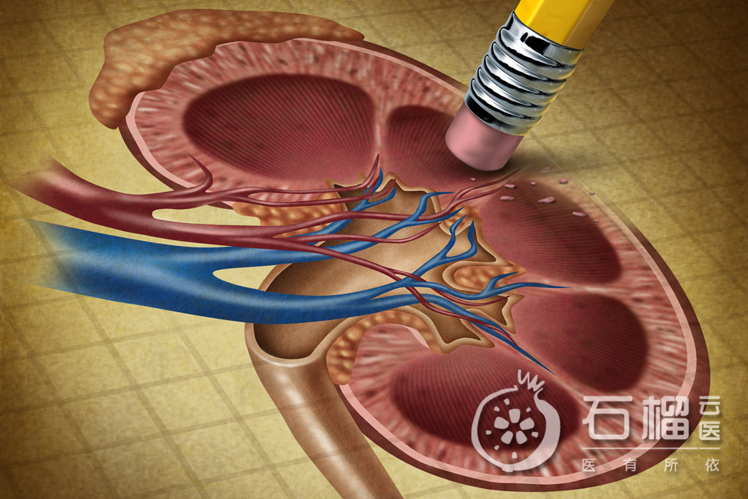 肾虚看中医需要做检查吗,肾虚一定要看医生吗