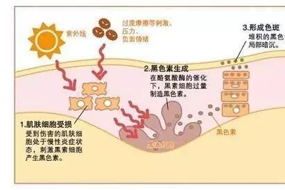 怎么淡化色斑小方法视频,怎么样淡化色斑食疗