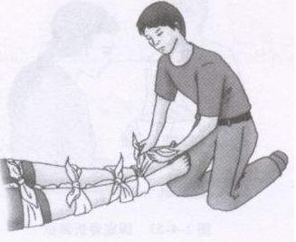 幼儿园骨折处理的急救步骤动画片,小孩子摔倒怎么急救