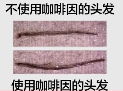 各种类型脱发真实脱发图片,为什么有些人脱发从头顶开始脱