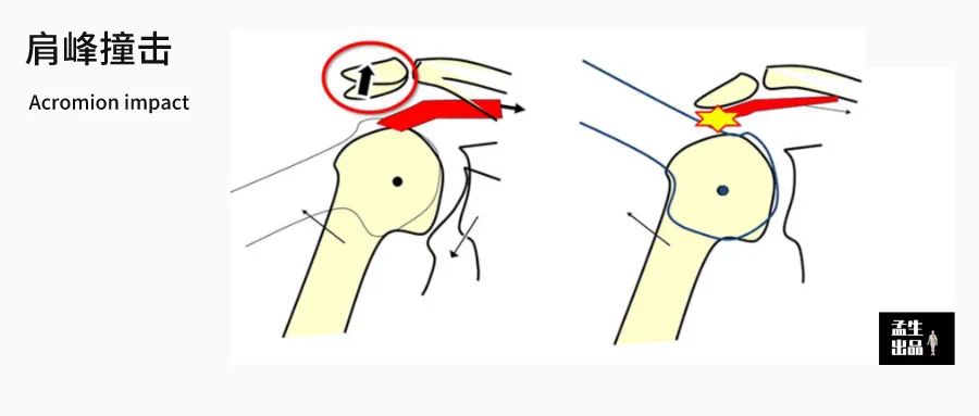 肩关节与肩胛骨的结构图,肩胛骨深层肌肉解剖图