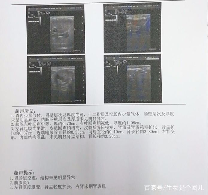 养宠小知识猫慢性肾衰竭治疗方法,猫咪肾衰竭救活大概多少钱