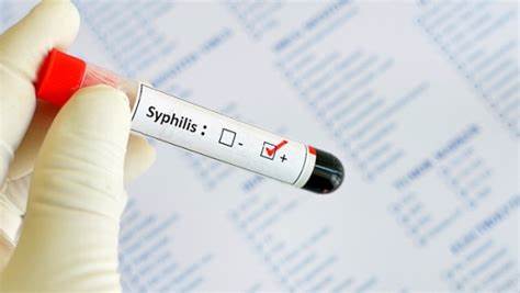 梅毒检查是阳性但是不传染了,梅毒检测阳性会传染吗