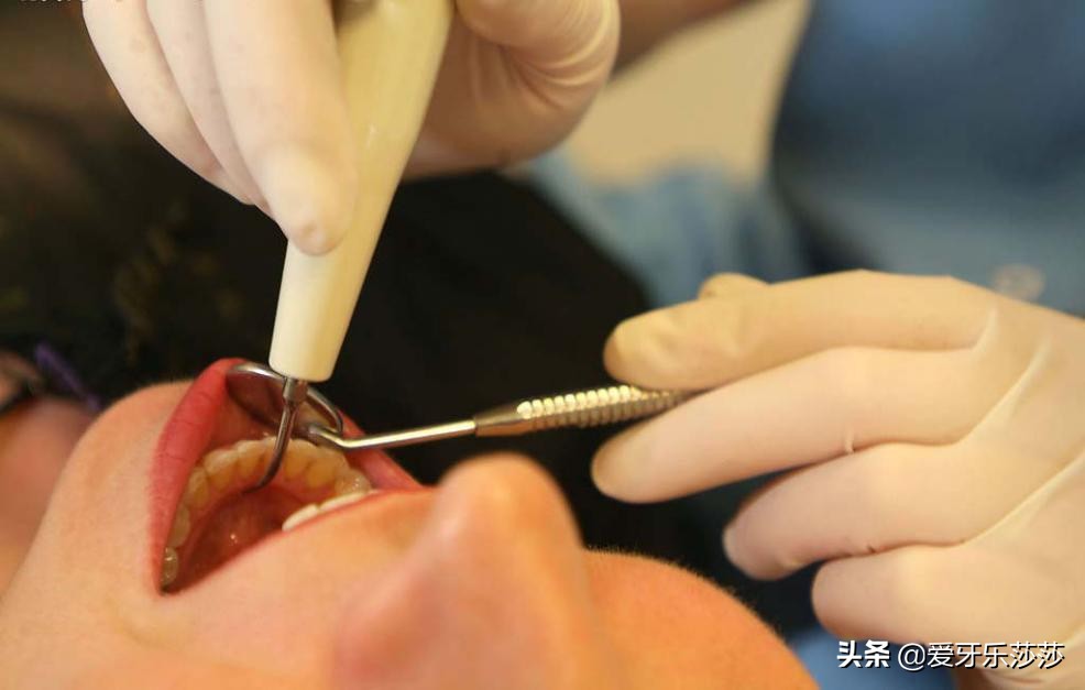 根管治疗2年后牙疼怎么办,牙疼根管治疗最后一次了