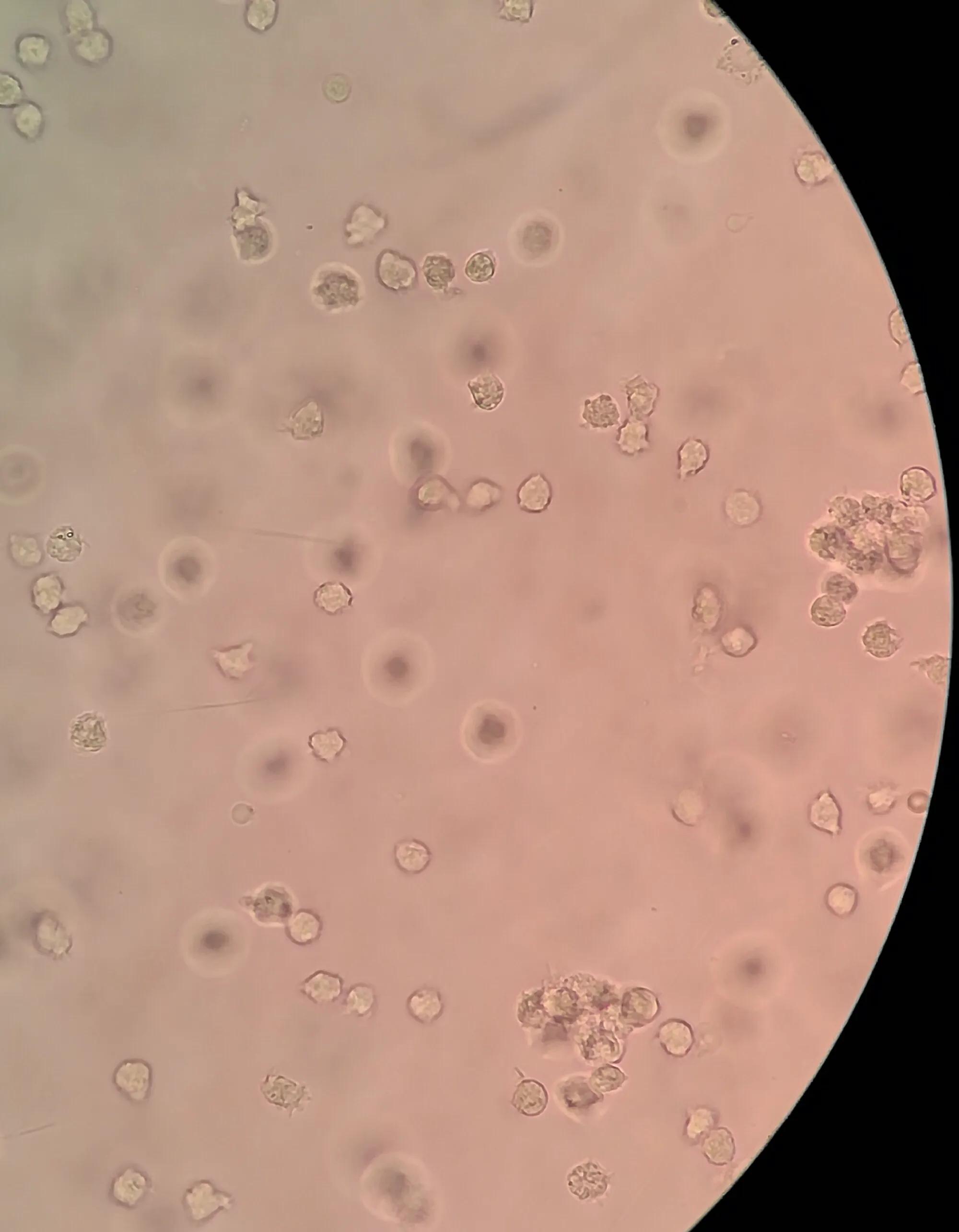 看尿酸化验单,检查尿酸600以上的图片