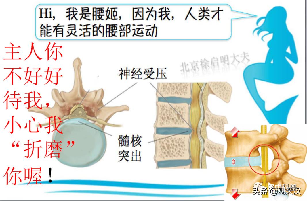 「专家讲科普」*建华陈**：守护好自己的脊梁——腰椎健康保健及防治知识