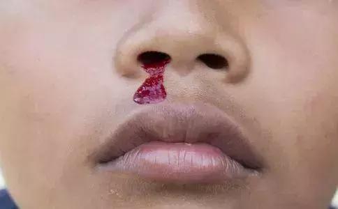 17岁高中生老想吐怎么了,17岁中学生呕吐去世