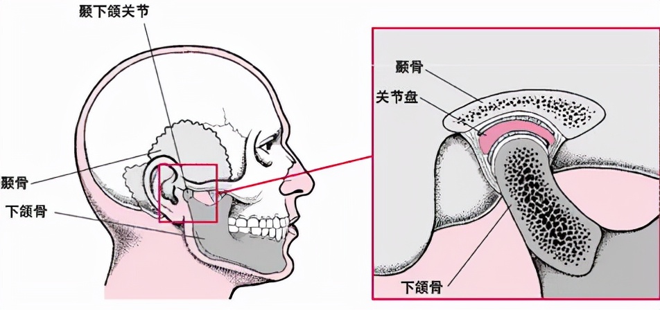 下巴歪斜矫正图,下颌紊乱大小脸矫正