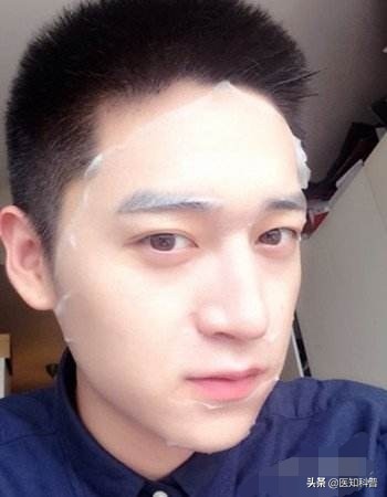 解决油性皮肤的最好方法,油性皮肤怎么办医问医答