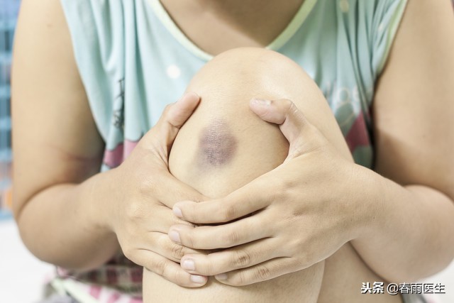 土豆消肿化瘀要敷一晚上,土豆和鸡蛋哪个消除淤青好