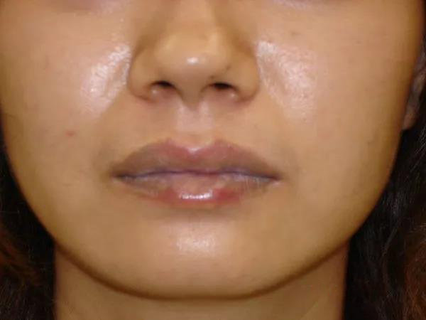 皮肤太黑被人嘲笑怎么办,皮肤暗黄十大救星