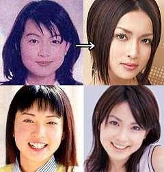 这个你察觉不到的小手术，滨崎步和80%的日本女星都做过它