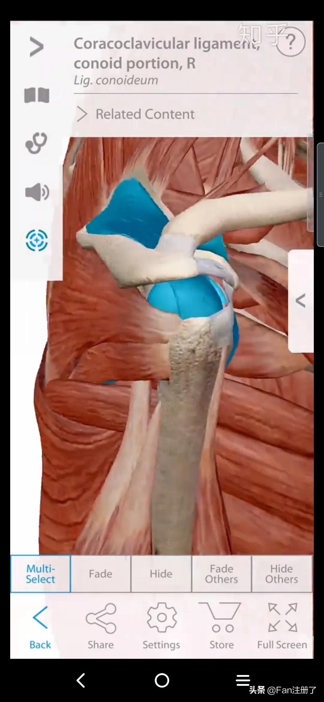 肩痛肩袖损伤针刀治疗,肩痛肩关节活动受限用什么药