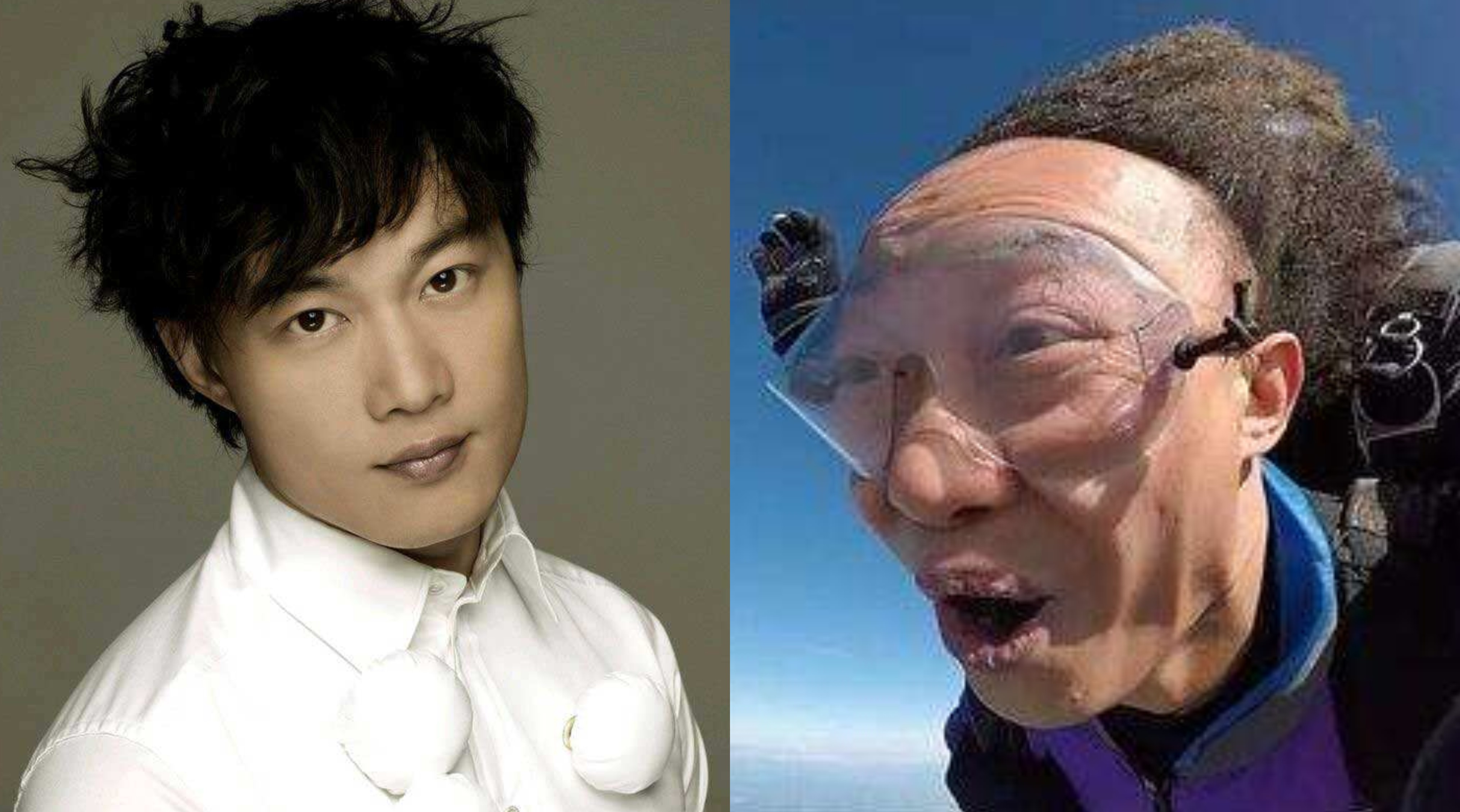 m型脱发也帅的男明星,帅气也挡不住脱发的10位男明星