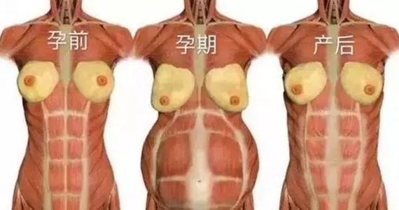 产后腰椎间盘突出正确锻炼方法,产后没有恢复好腰疼