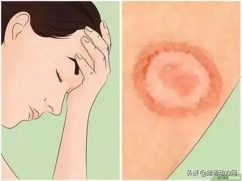 消灭蜱虫的药,蜱虫的毒性有多强