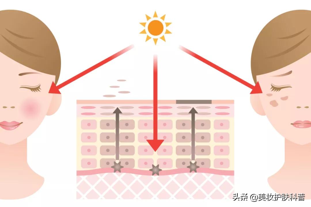 三月不防晒有什么说法,被太阳晒起斑怎么祛斑
