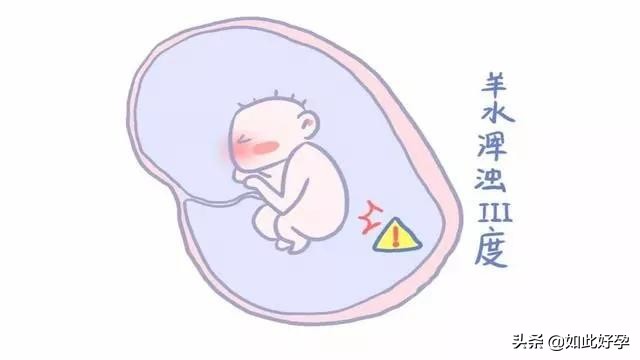 孕期几个月开始关注羊水问题,羊水漏了一点不漏要马上去医院吗