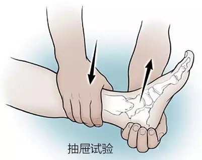 澶栬笣闊у甫鎹熶激澶栬笣鑲胯儉澶氶暱鏃堕棿,澶栬笣闊у甫鎹熶激鑳借瘎娈嬪悧