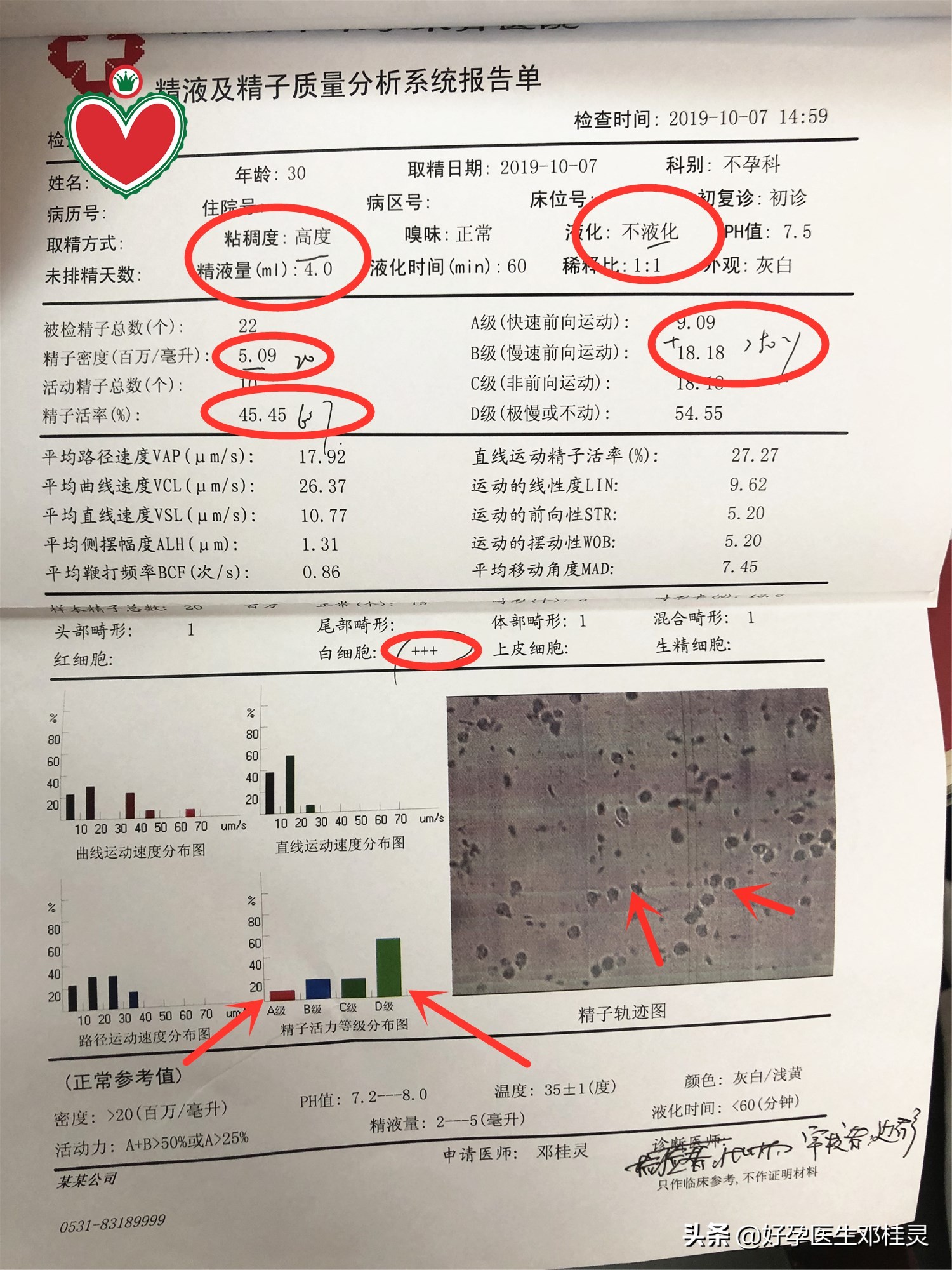 一张精液报告单引发的男人健康指南——除了吃药，多喝水不是玩笑
