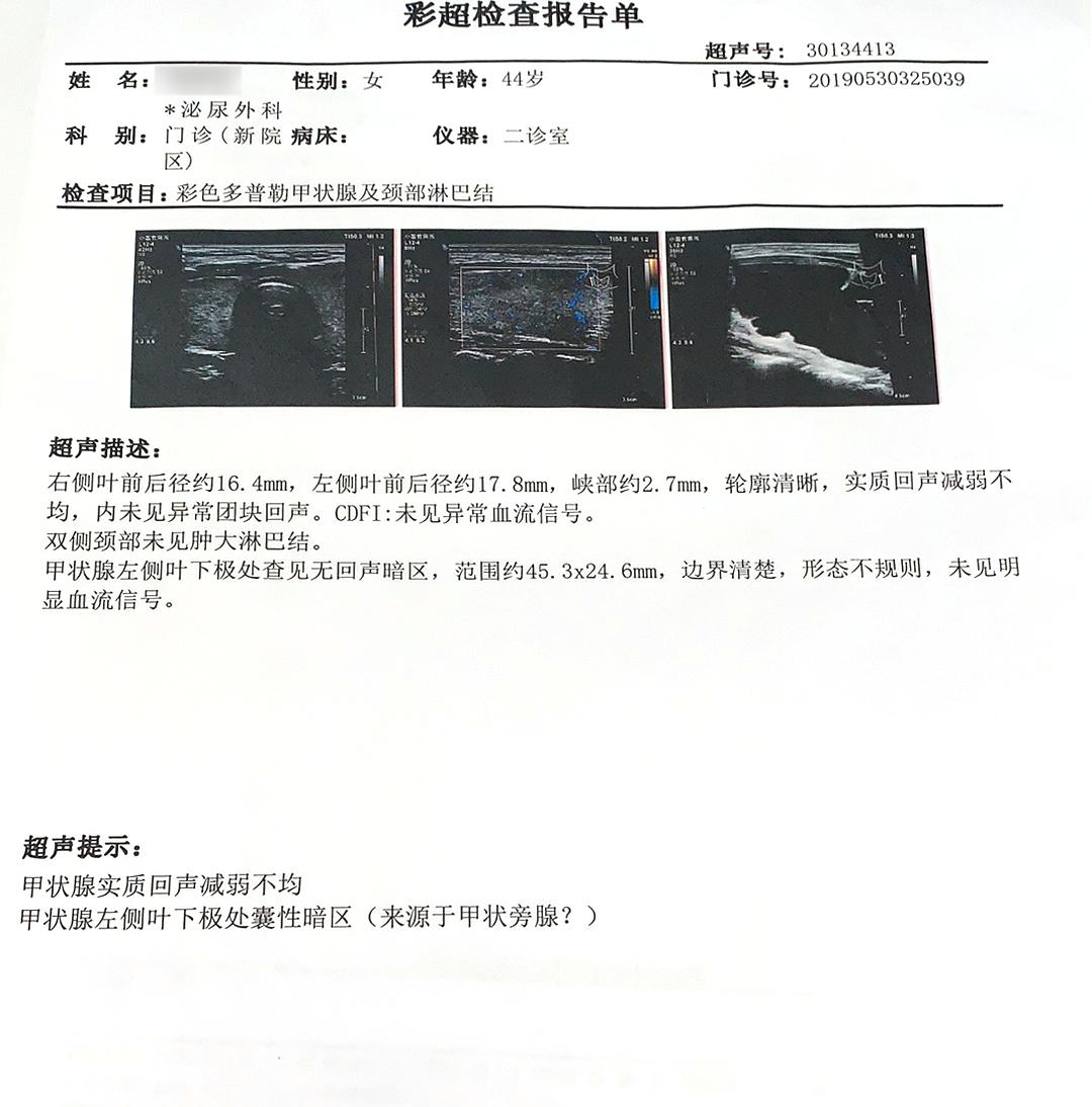 甲状腺结节从18mm一年长到23mm,一年内长出2mm甲状腺结节