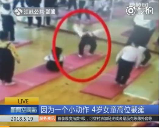 小孩高位截瘫功能锻炼,4岁孩子下腰瘫痪