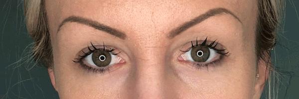 长期开车眼睛劳累有什么好办法,长期开车有助于恢复视力